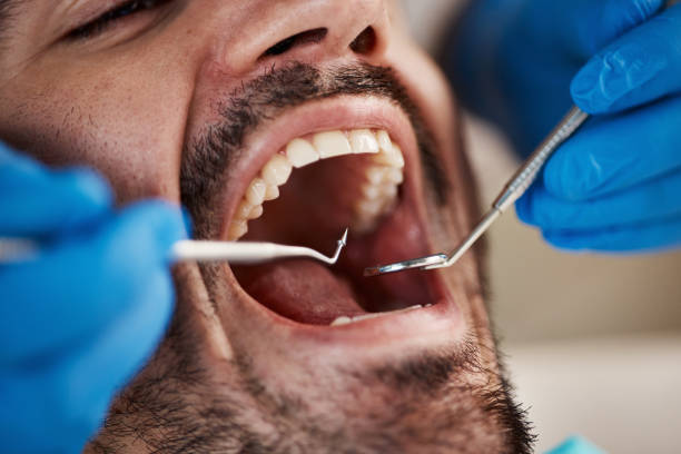 Best Cracked Tooth Emergency Dentist  in Mesa Del Caballo, AZ